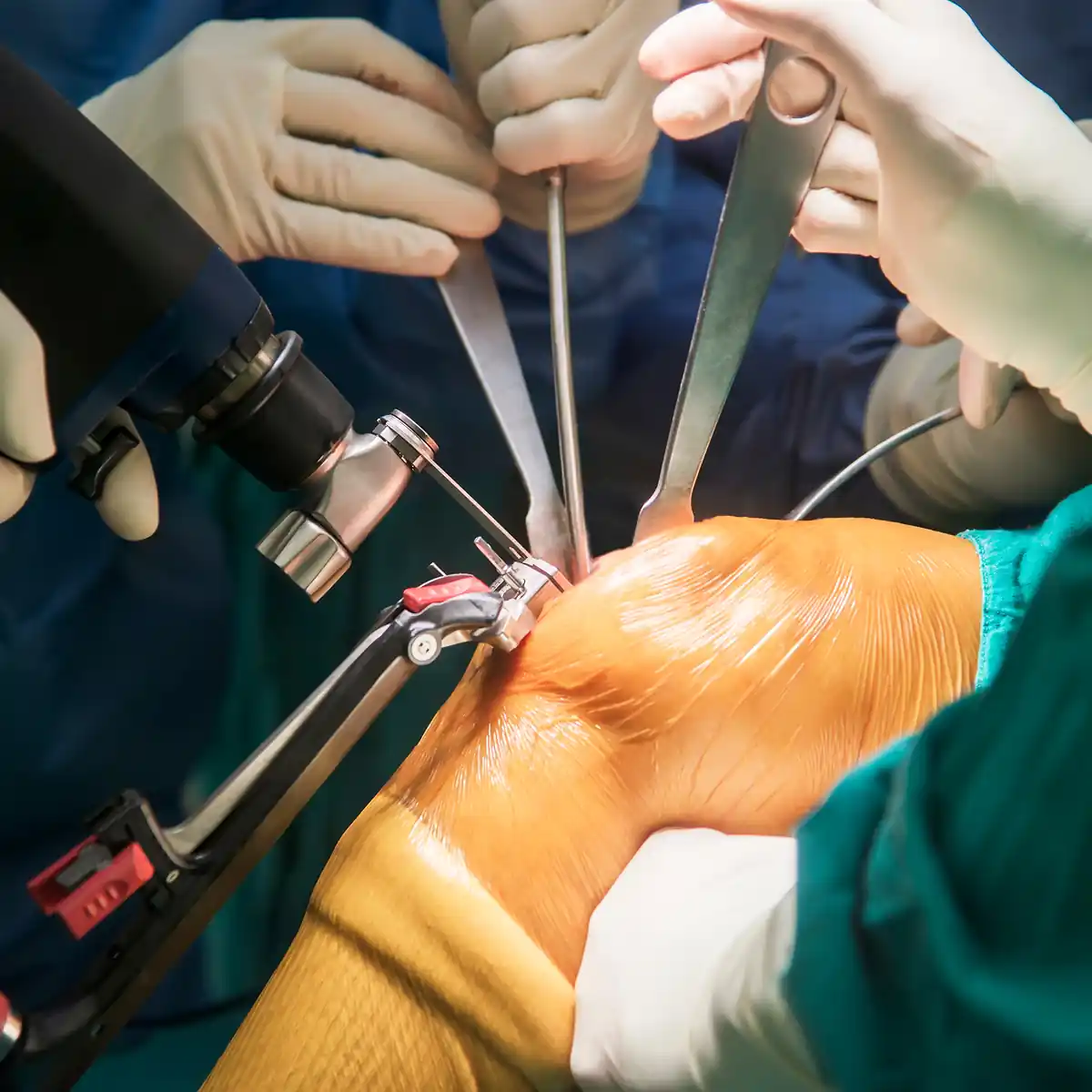 Orthopedic surgery teaching and documentation with surgical head camera