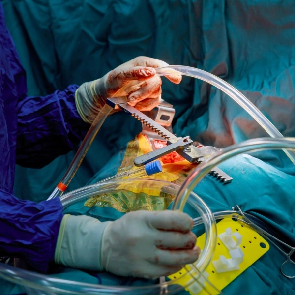4K surgical field camera for cardiothoracic and general surgery OR overview